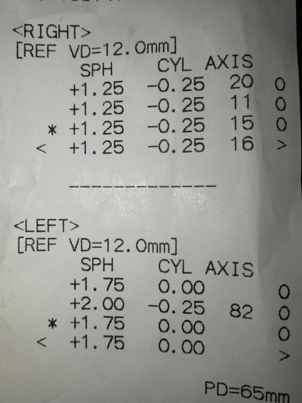 Göz testi sonucu